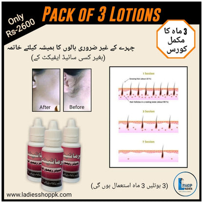 Pack Of 3 Permanent Facial Hair Remover Lotion