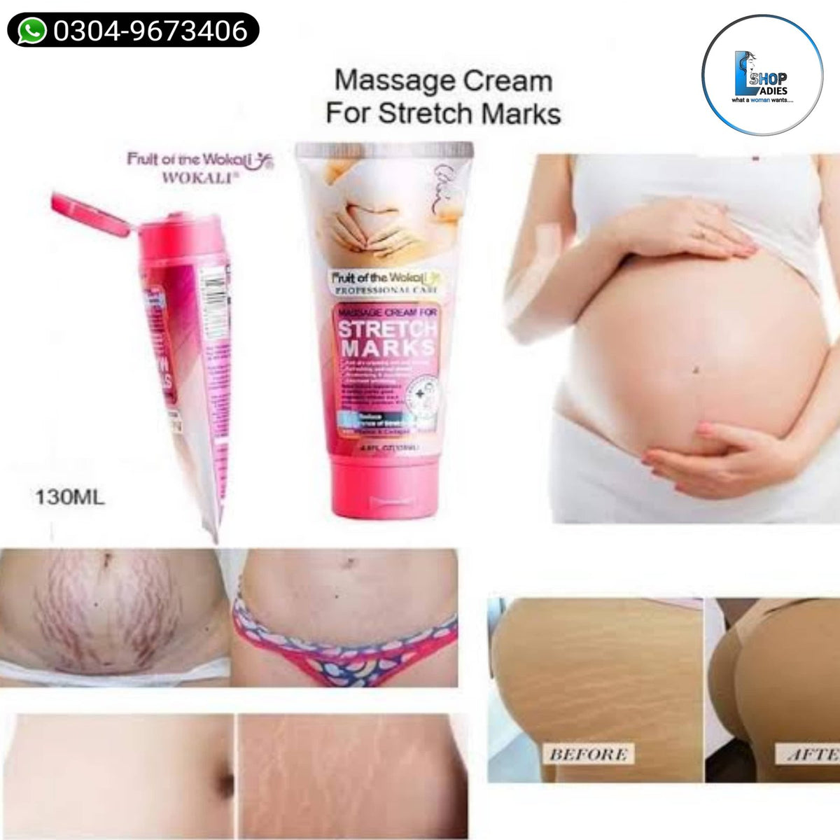 Wokali STRETCH MARK CREAM - 140ML