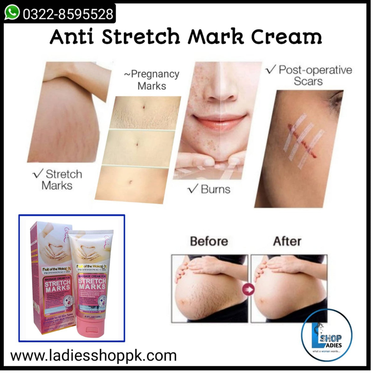 Wokali STRETCH MARK CREAM - 140ML