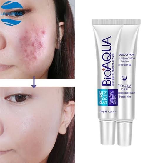 Bioaqua Acne Cream Original