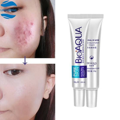 Bioaqua Acne Cream Original