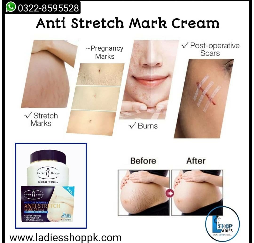 aichun stretch mark cream