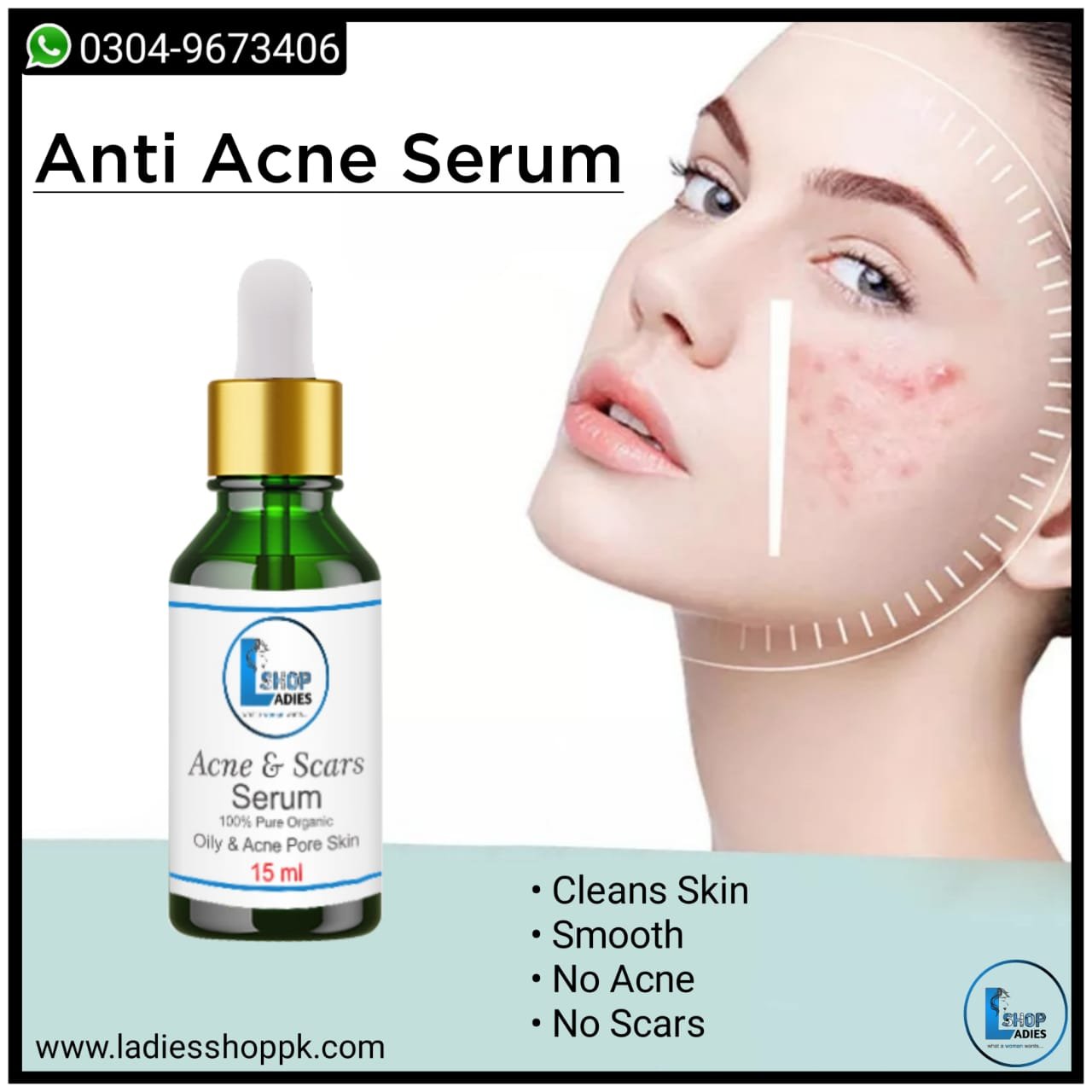 Anti Acne Serum 15ml Ladies Shop